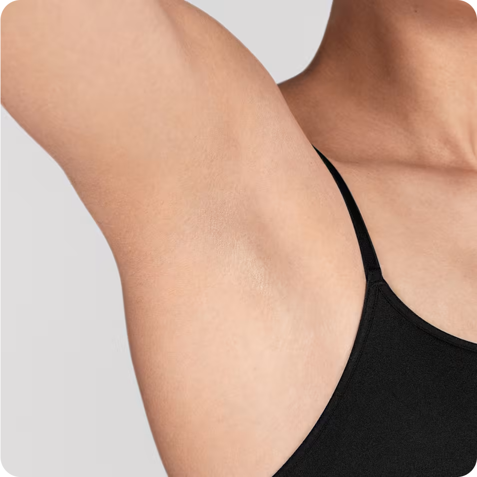 Woman's underarm after 6 sessions