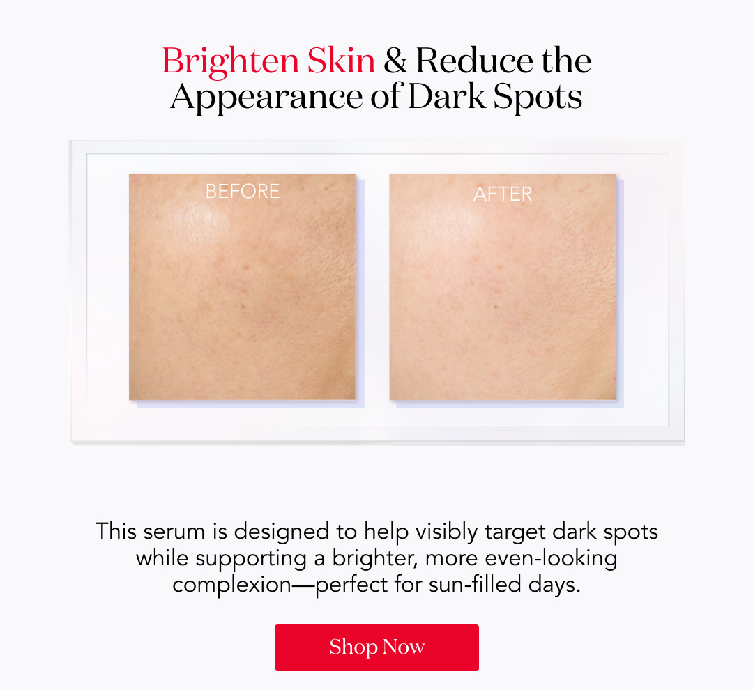 Brighten skin & reduce the appearance of dark spots  Before | After  This serum is designed to help visibly target dark spots while supporting a brighter, more even-looking complexion—perfect for sun-filled days.  Shop now