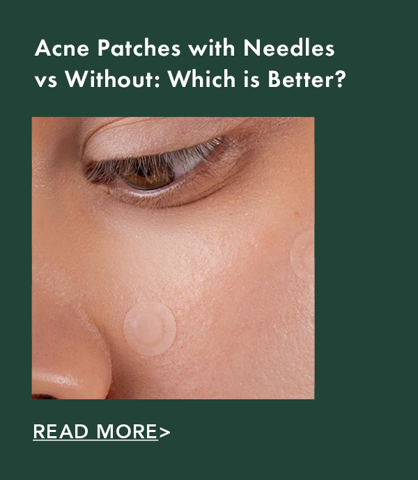 Acne Patches with Needles vs Without: Which is Better? Read More. Acne Patches with Needles vs Without: Which is Better? Read More.