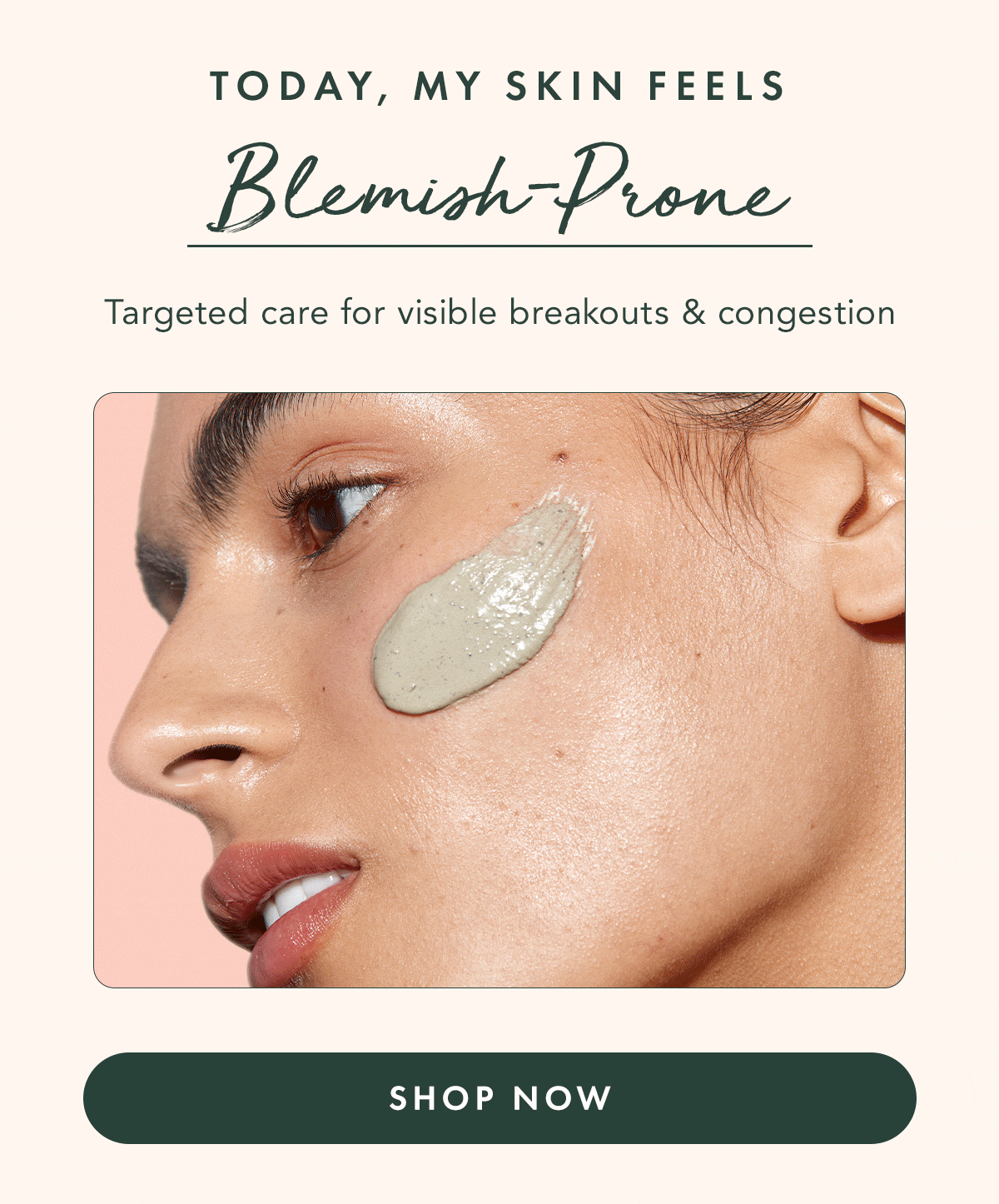 Blemish-Prone Skin. Targeted care for visible breakouts and congestion. Shop Now