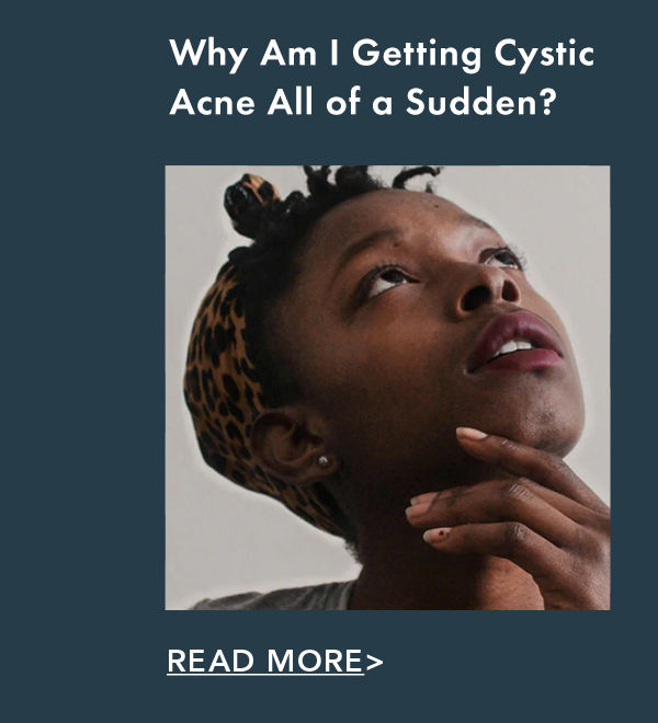Why Am I Getting Cystic Acne All of a Sudden? Read More. Why Am I Getting Cystic Acne All of a Sudden? Read More.
