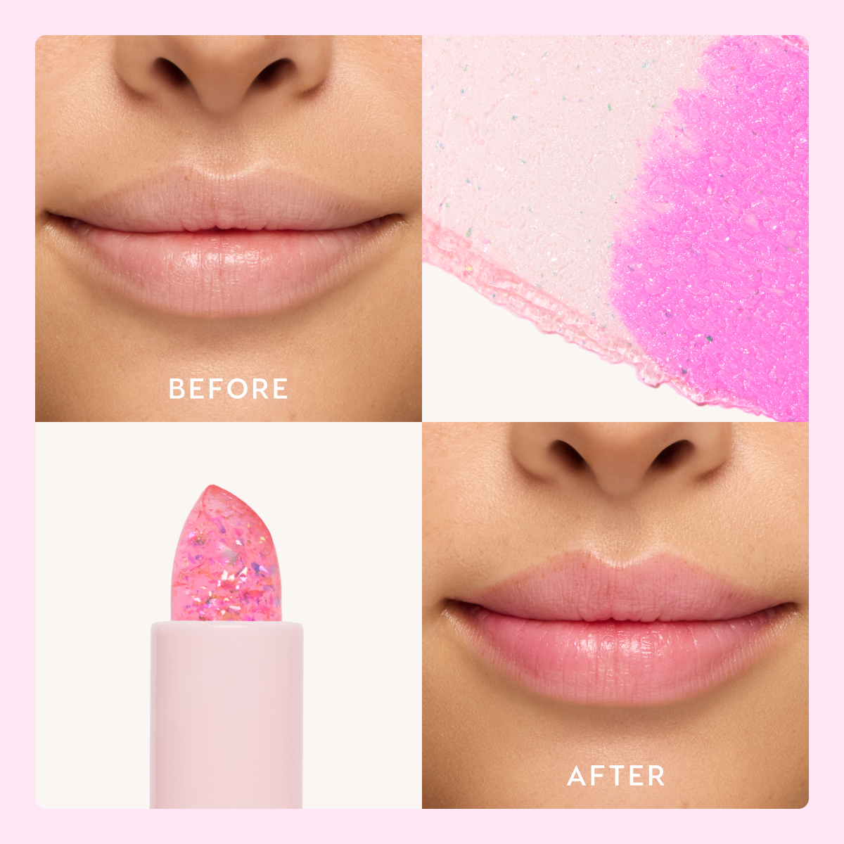 Before and After