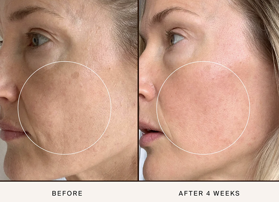 chebula active serum