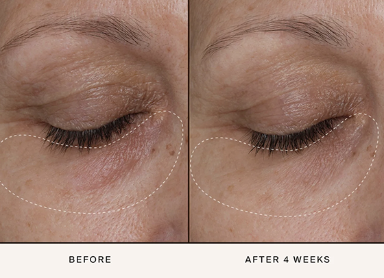 Pure Radiance Supreme Eye Cream