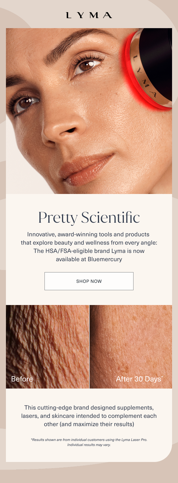 lyma. pretty scientific. innovative, award winning tools and products that explre beauty and wellness from every angle. the hsa/fsa eligible brand lyma is now available at bluemercury. shop now. before and after imagery. this cutting edge brand designed supplements, lasers, and skincare intended to complement each other and maximize their results. results shown are from individual customers using the lyma laser pro. individual results may vary.